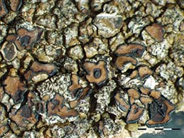 [Acarospora scotica]