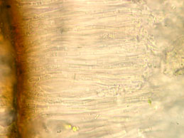 [Acarospora umbilicata]