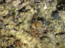 [Agonimia tristicula]