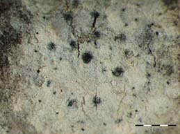 [Arthonia beccariana]