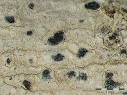 [Arthonia beccariana]