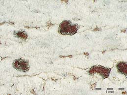 [Arthonia sanguinea]