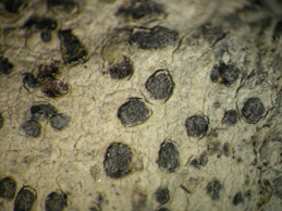 [Arthonia melanophthalma]