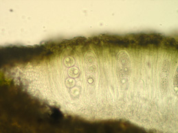 [Aspicilia calcarea]