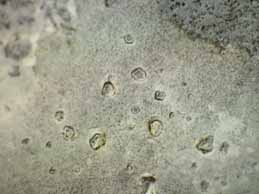 [Aspicilia coronata]