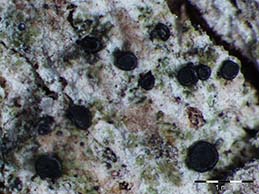 [Bacidia circumspecta]