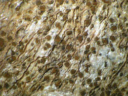 [Caloplaca scotoplaca]