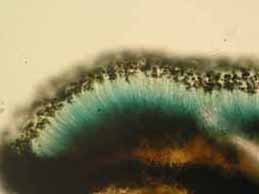 [Catillaria chalybeia]