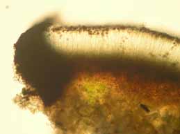 [Catillaria chalybeia chloropoliza]