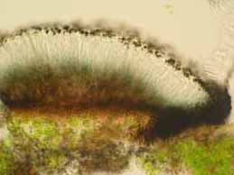 [Catillaria chalybeia]