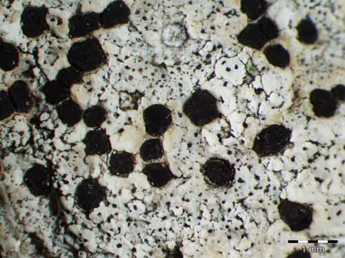 [Clauzadea metzleri]