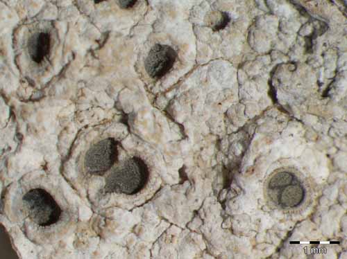 [Diploschistes diacaspis]