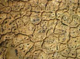 [Diploschistes actinostomus]