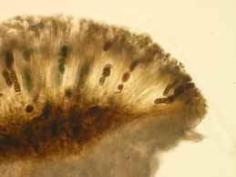 [Diplotomma hedinii]