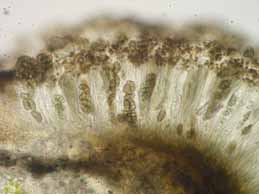 [Diplotomma pharcidium]