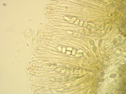 [Gyalecta truncigena]