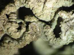 [Hypogymnia laminisorediata]