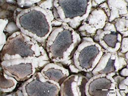 [Lecanora rhodi]