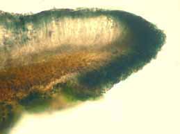 [Lecidella elaeochroma]