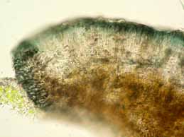 [Lecidella carpathica]