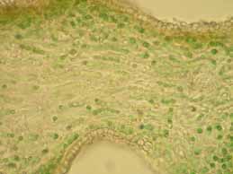 [Leptogium aragonii]