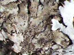 [Lichenochora thallina]