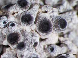 [Megaspora verrucosa]