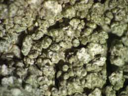 [Pertusaria albescens]