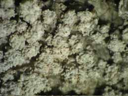 [Pertusaria albescens]