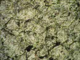 [Pertusaria coccodes]