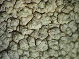 [Pertusaria pseudoparotica]