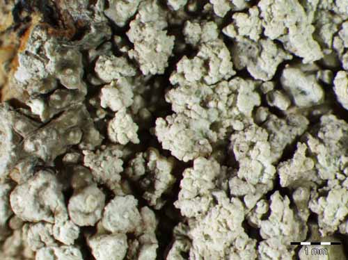 [Pertusaria albescens]