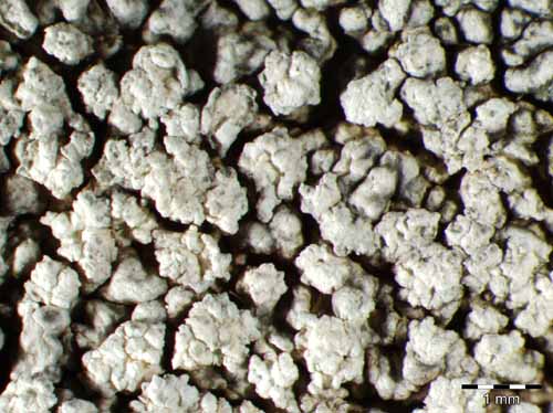 [Pertusaria aspergilla]