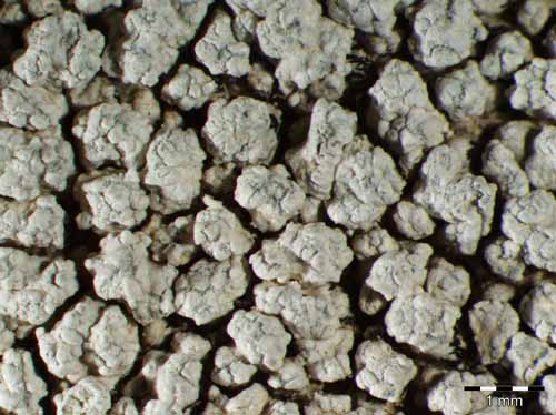 [Pertusaria leucosora]