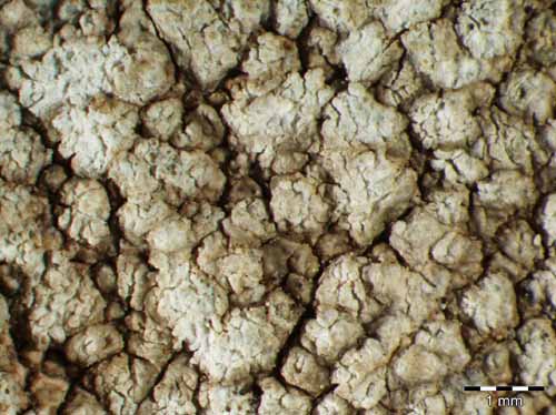 [Pertusaria leucosora]