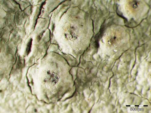 [Pertusaria werneriana]