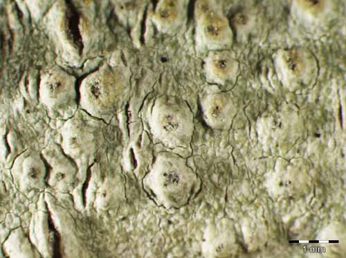 [Pertusaria werneriana]