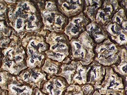 [Pertusaria chiodectonoides]