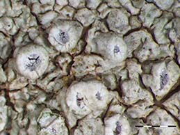 [Pertusaria ophthalmiza]