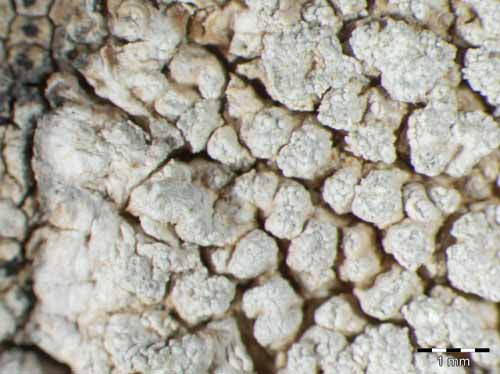 [Pertusaria leucosora]