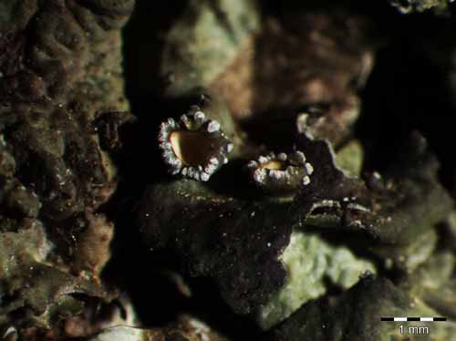 [Pleurosticta acetabulum]