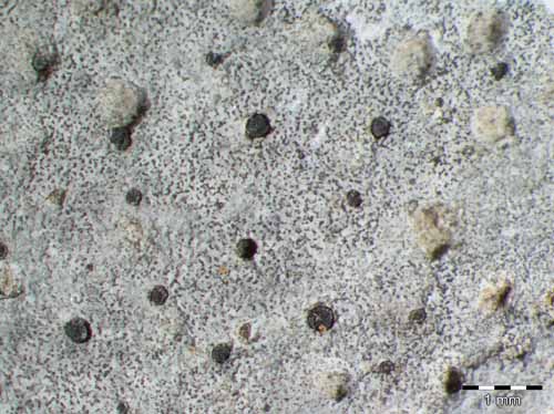 [Polyblastia albida]