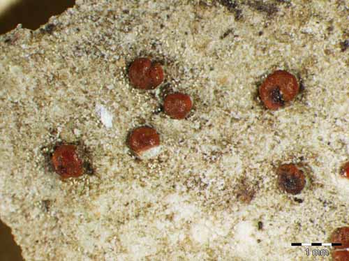 [Protoblastenia cyclospora]