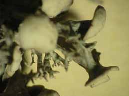 [Ramalina fastigiata]