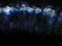 [Rhizocarpon richardii]