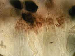 [Rhizocarpon geographicum]