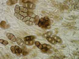 [Rinodina trachytica]