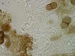 [Rinodina obnascens]