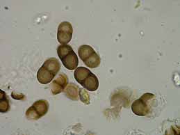 [Rinodina obnascens]