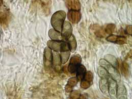 [Rinodina beccariana]